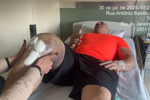 Daniel Silveira mostra perna roxa e pede por prisão domiciliar